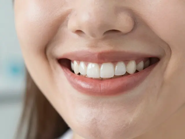 Způsoby, jak keramické fazety zlepšují úsměv - od barev po trvanlivost