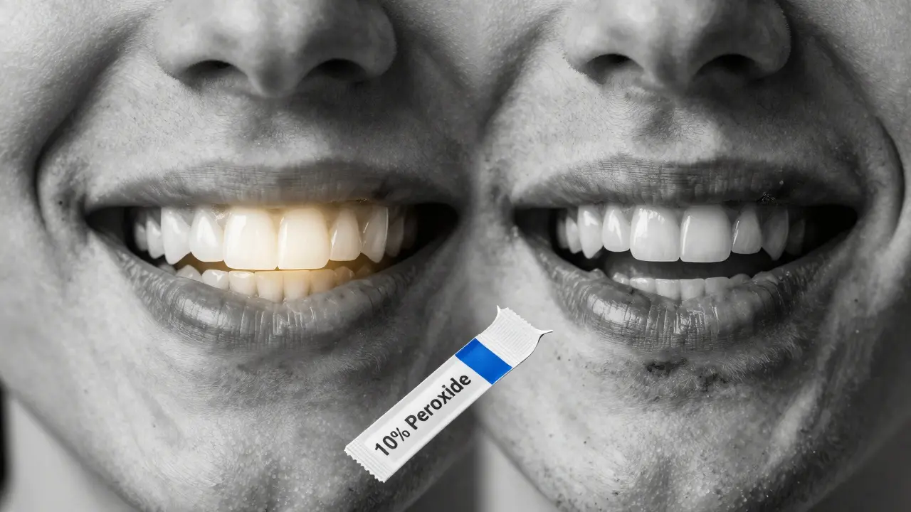 Dvě cesty k bílým zubům: bezpečná obnova hydroxyapatitem a poškození příliš silným bělením.