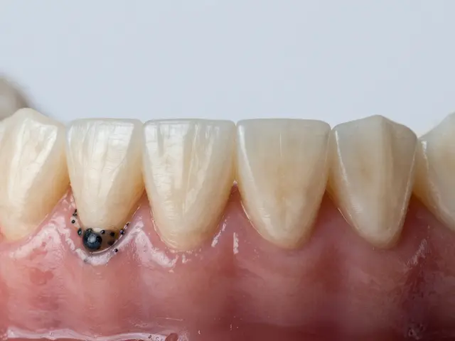 Proč odstranit černý zubní kámen? Zdravotní rizika a efektivní řešení