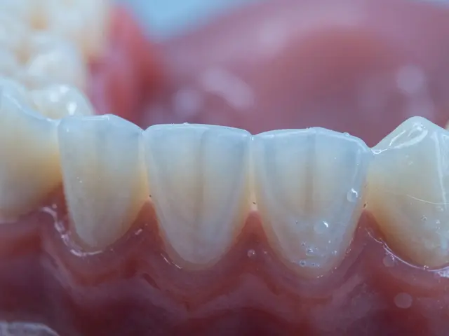 Zubní plak u nošitelů náhradních zubů: rizika a správná hygiena