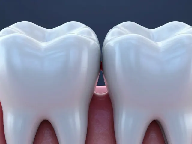 Jak mezizubní kaz ovlivňuje celkové zdraví a proč ho nesmíte ignorovat