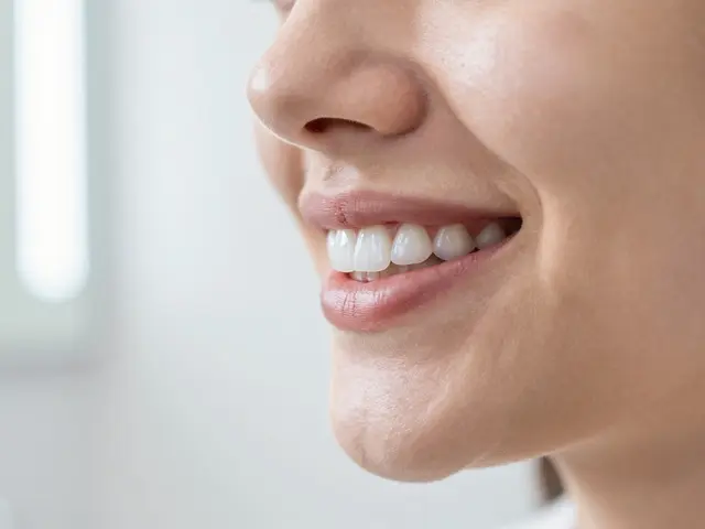 Zkušenosti s nalepovacími zuby: Fungují opravdu, nebo jsou to vyhozené peníze?