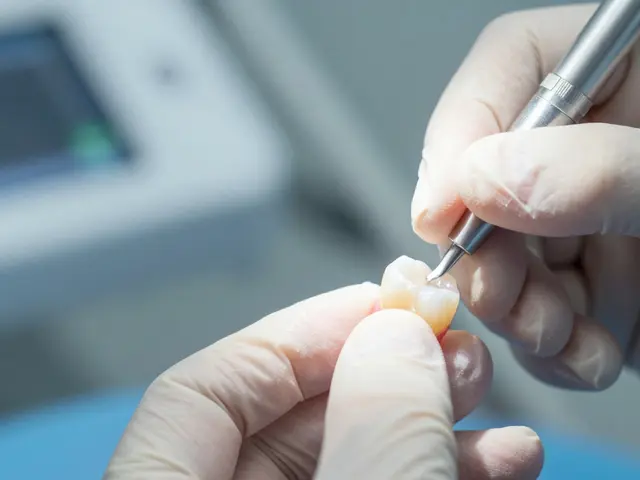 Kompozitní fazeta: Vše, co potřebujete vědět o ceně, životnosti a alternativách