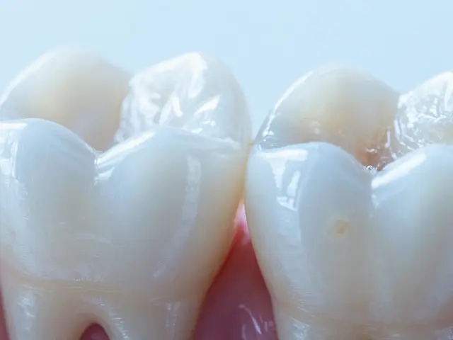 Jak se léčí zubní kaz: Od vyplňování až po endodoncii